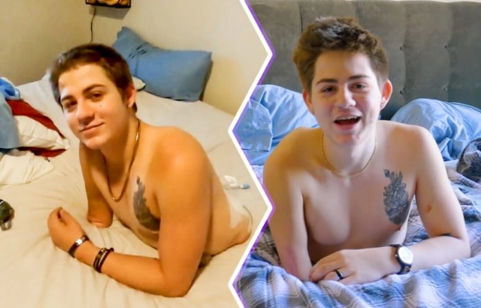 After Being Split in Two by a Forklift, This Teenager Defied All Odds – His Story Will Amaze You