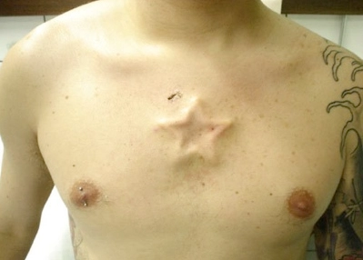 Forbidden Modifications: Top 10 Procedures You Won't Believe Are Real.